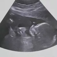Foto de perfil Karla y Marcelo