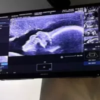 Foto de perfil JENNIFFER CANO